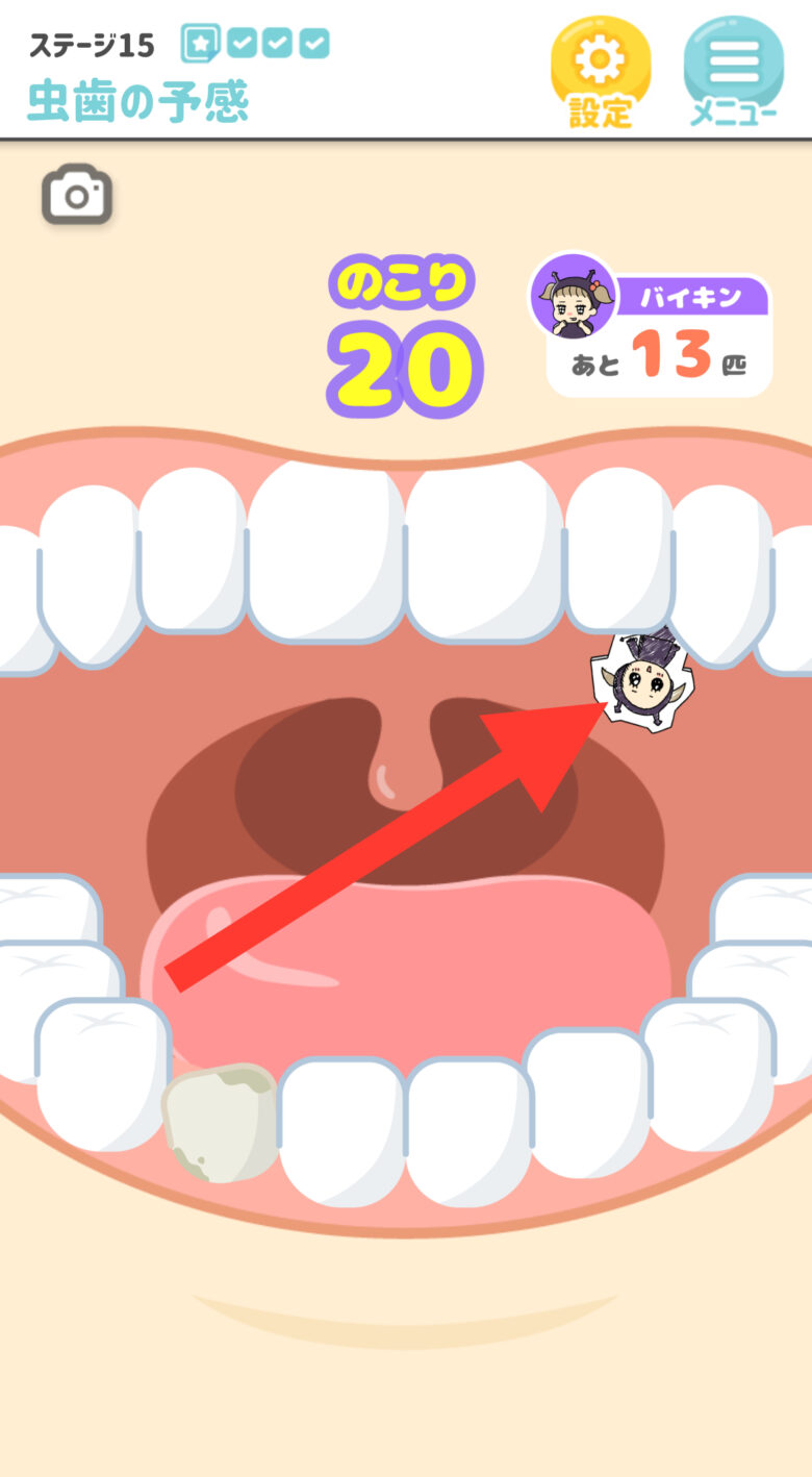 ステージ15　虫歯の予感